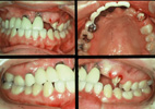�C���v�����g���ÑO