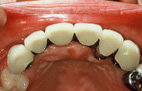 �C���v�����g����������