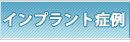 �C���v�����g�Ǘ�